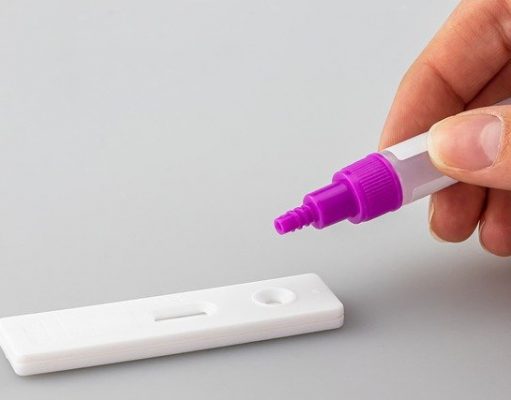 Rapid tests must be paid for by the patient in most cases as of now Rapid tests must be paid for by the patient in most cases as of now